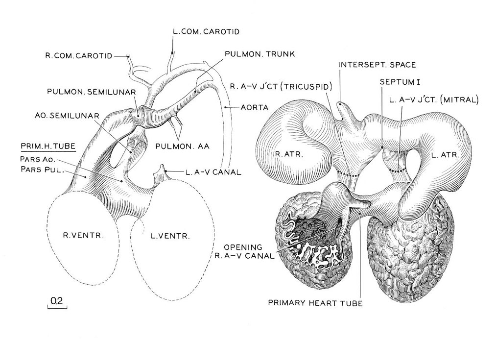Reconstruction of the endocardium of the heart